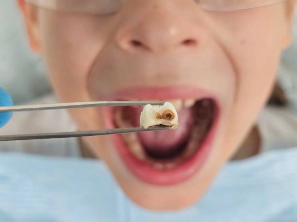 Best Emergency Gum Pain Relief  in Mason, MI